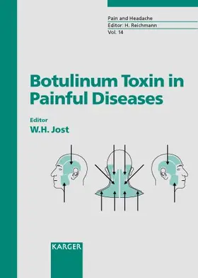 Jost |  Botulinum Toxin in Painful Diseases | Buch |  Sack Fachmedien
