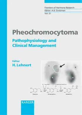 Lehnert |  Pheochromocytoma | Buch |  Sack Fachmedien