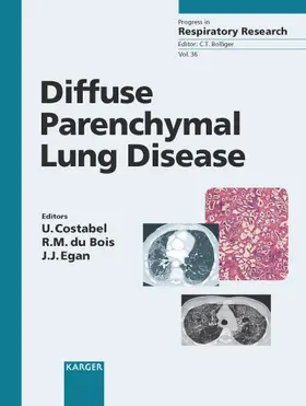 Costabel / du Bois / Egan |  Diffuse Parenchymal Lung Disease | Buch |  Sack Fachmedien