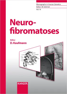 Kaufmann |  Neurofibromatoses | Buch |  Sack Fachmedien