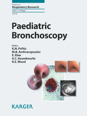 Priftis / Anthracopoulos / Eber |  Paediatric Bronchoscopy | Buch |  Sack Fachmedien