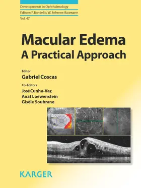 Coscas / Cunha-Vaz / Loewenstein |  Macular Edema | Buch |  Sack Fachmedien