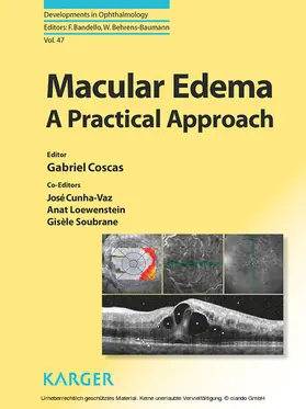 Coscas / Cunha-Vaz / Loewenstein |  Macular Edema | eBook | Sack Fachmedien