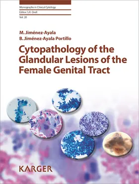 Jiménez-Ayala / Viehl |  Cytopathology of the Glandular Lesions of the Female Genital Tract | eBook | Sack Fachmedien