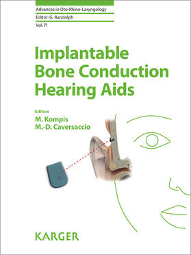 Kompis / Caversaccio |  Implantable Bone Conduction Hearing Aids | eBook | Sack Fachmedien