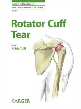 Maffulli |  Rotator Cuff Tear | eBook | Sack Fachmedien