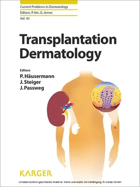 Häusermann / Passweg / Steiger |  Transplantation Dermatology | eBook | Sack Fachmedien