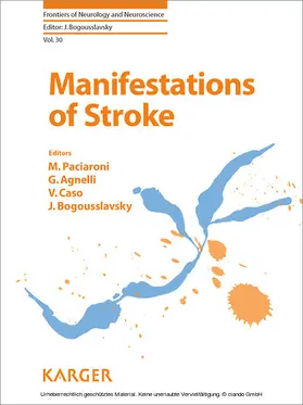 Paciaroni / Agnelli / Caso |  Manifestations of Stroke | eBook | Sack Fachmedien