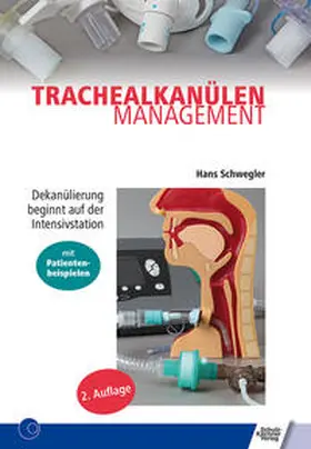Schwegler | Trachealkanülenmanagement | Buch | 978-3-8248-1162-5 | www.sack.de