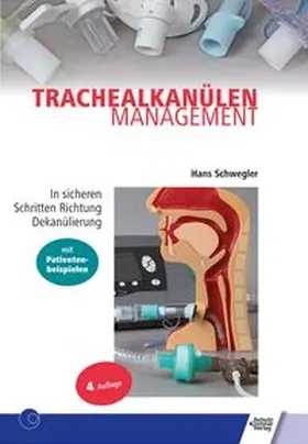 Schwegler | Trachealkanülenmanagement | Buch | 978-3-8248-1260-8 | www.sack.de