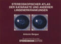 Bergua |  Stereoskopischer Atlas der Katarakte und anderer Linsenerkrankungen | Buch |  Sack Fachmedien