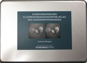 Bergua |  Stereoskopischer Fluoresceinangiographie-Atlas des Augenhintergrundes | Sonstiges |  Sack Fachmedien