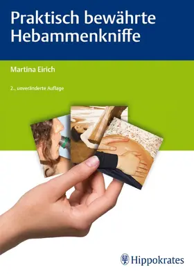 Eirich | Praktisch bewährte Hebammenkniffe | E-Book | www.sack.de
