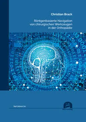 Brack |  Röntgenbasierte Navigation von chirurgischen Werkzeugen in der Orthopädie | Buch |  Sack Fachmedien