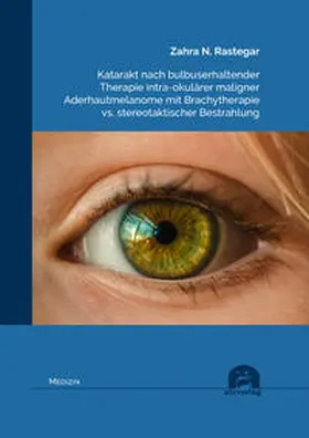 Rastegar |  Katarakt nach bulbuserhaltender Therapie intra-okulärer maligner Aderhautmelanome mit Brachytherapie vs. stereotaktischer Bestrahlung | Buch |  Sack Fachmedien