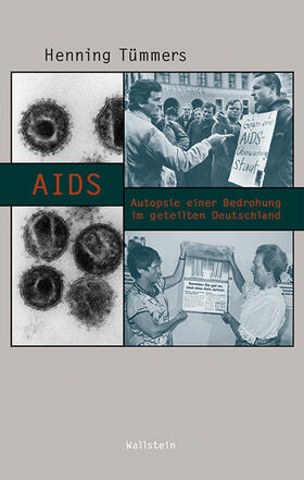 Tümmers | AIDS | Buch | 978-3-8353-3005-4 | sack.de