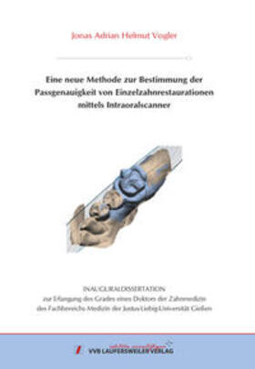 Vogler | Eine neue Methode zur Bestimmung der Passgenauigkeit von Einzelzahnrestaura-tionen mittels Intraoralscanner | Buch | 978-3-8359-6912-4 | sack.de