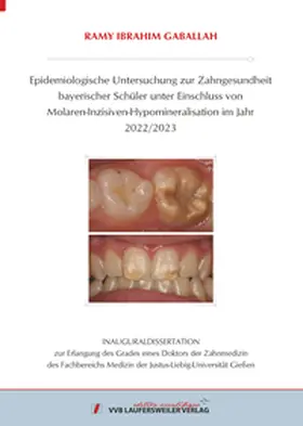 Gaballah |  Epidemiologische Untersuchung zur Zahngesundheit bayerischer Schüler unter Einschluss von Molaren-Inzisiven-Hypomineralisation im Jahr 2022/2023 | Buch |  Sack Fachmedien