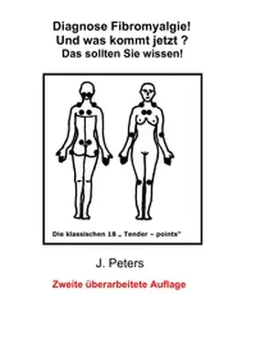 Peters |  Diagnose Fibromyalgie! Und was kommt jetzt? | Buch |  Sack Fachmedien