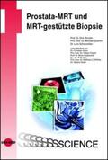 Blondin / Quentin / Schimmöller |  Prostata-MRT und MRT-gestützte Biopsie | Buch |  Sack Fachmedien