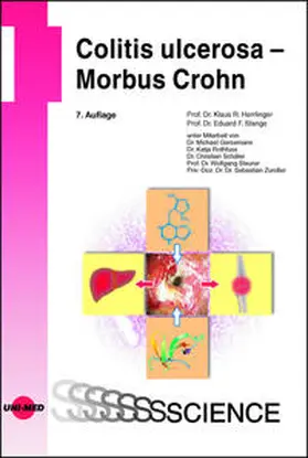 Herrlinger / Stange |  Colitis ulcerosa - Morbus Crohn | Buch |  Sack Fachmedien