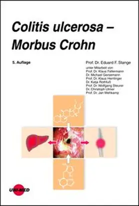 Stange | Colitis ulcerosa - Morbus Crohn | Buch | 978-3-8374-2362-4 | www.sack.de