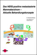 Welslau / Wenzel |  Das HER2-positive metastasierte Mammakarzinom - Aktuelle Behandlungskonzepte | Buch |  Sack Fachmedien