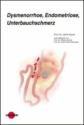 Karck |  Dysmenorrhoe, Endometriose, Unterbauchschmerz | eBook | Sack Fachmedien