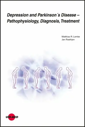 Lemke / Raethjen |  Depression and Parkinson´s Disease - Pathophysiology, Diagnosis, Treatment | eBook | Sack Fachmedien