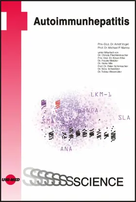 Vogel / Manns |  Autoimmunhepatitis | eBook | Sack Fachmedien