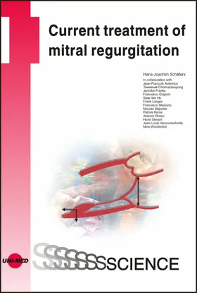 Schäfers |  Current treatment of mitral regurgitation | eBook | Sack Fachmedien