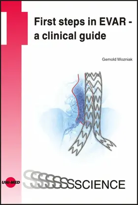 Wozniak |  First steps in EVAR - a clinical guide | eBook | Sack Fachmedien