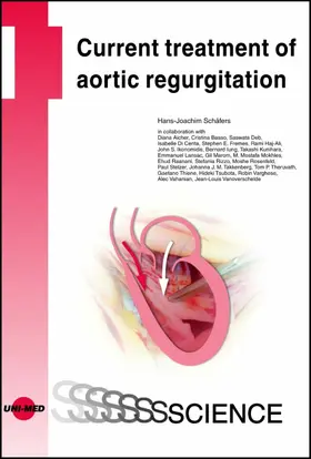Schäfers |  Current treatment of aortic regurgitation | eBook | Sack Fachmedien