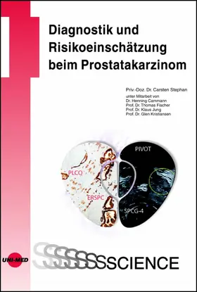 Stephan |  Diagnostik und Risikoeinschätzung beim Prostatakarzinom | eBook | Sack Fachmedien
