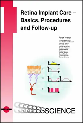 Walter |  Retina Implant Care - Basics, Procedures and Follow-up | eBook | Sack Fachmedien