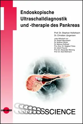 Hollerbach / Jürgensen |  Endoskopische Ultraschalldiagnostik und -therapie des Pankreas | eBook | Sack Fachmedien