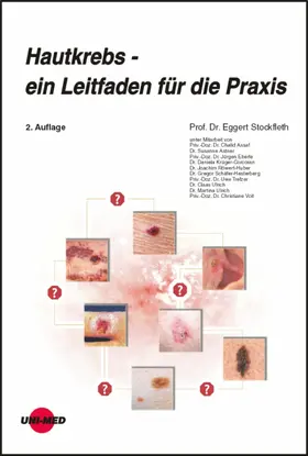 Stockfleth |  Hautkrebs - ein Leitfaden für die Praxis | eBook | Sack Fachmedien
