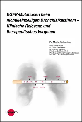 Sebastian |  EGFR-Mutationen beim nichtkleinzelligen Bronchialkarzinom - Klinische Relevanz und therapeutisches Vorgehen | eBook | Sack Fachmedien