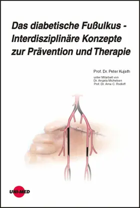 Kujath |  Das diabetische Fußulkus - Interdisziplinäre Konzepte zur Prävention und Therapie | eBook | Sack Fachmedien