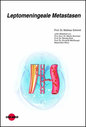 Schmid |  Leptomeningeale Metastasen | eBook | Sack Fachmedien