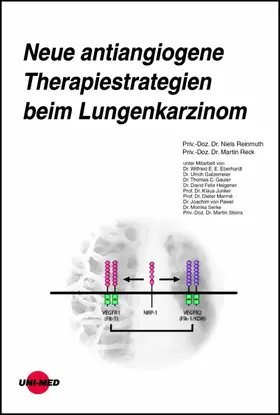 Reinmuth / Reck |  Neue antiangiogene Therapiestrategien beim Lungenkarzinom | eBook | Sack Fachmedien