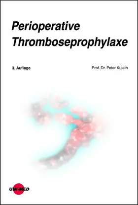 Kujath |  Perioperative Thromboseprophylaxe | eBook | Sack Fachmedien