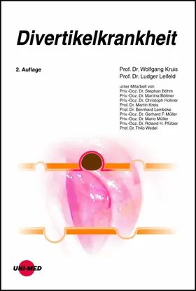 Kruis / Leifeld |  Divertikelkrankheit | eBook | Sack Fachmedien
