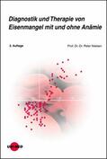 Nielsen |  Diagnostik und Therapie von Eisenmangel mit und ohne Anämie | eBook | Sack Fachmedien