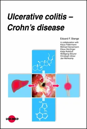 Stange |  Ulcerative colitis - Crohn's disease | eBook | Sack Fachmedien