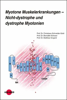 Schneider-Gold / Schoser / Vorgerd |  Myotone Muskelerkrankungen - Nicht-dystrophe und dystrophe Myotonien | eBook | Sack Fachmedien