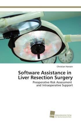 Hansen |  Software Assistance in Liver Resection Surgery | Buch |  Sack Fachmedien