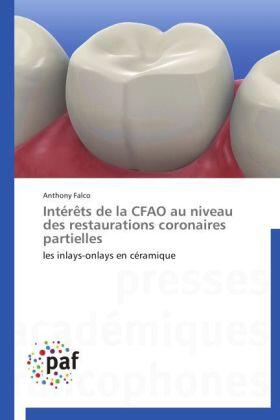 Falco |  Intérêts de la CFAO au niveau des restaurations coronaires partielles | Buch |  Sack Fachmedien
