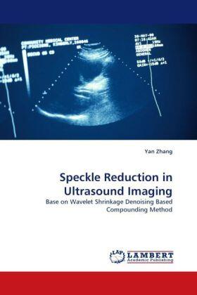 Zhang | Speckle Reduction in Ultrasound Imaging | Buch | 978-3-8383-9759-7 | www.sack.de