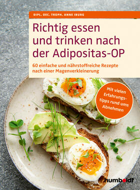 Iburg | Richtig essen und trinken nach der Adipositas-OP | Buch | 978-3-8426-3178-6 | sack.de